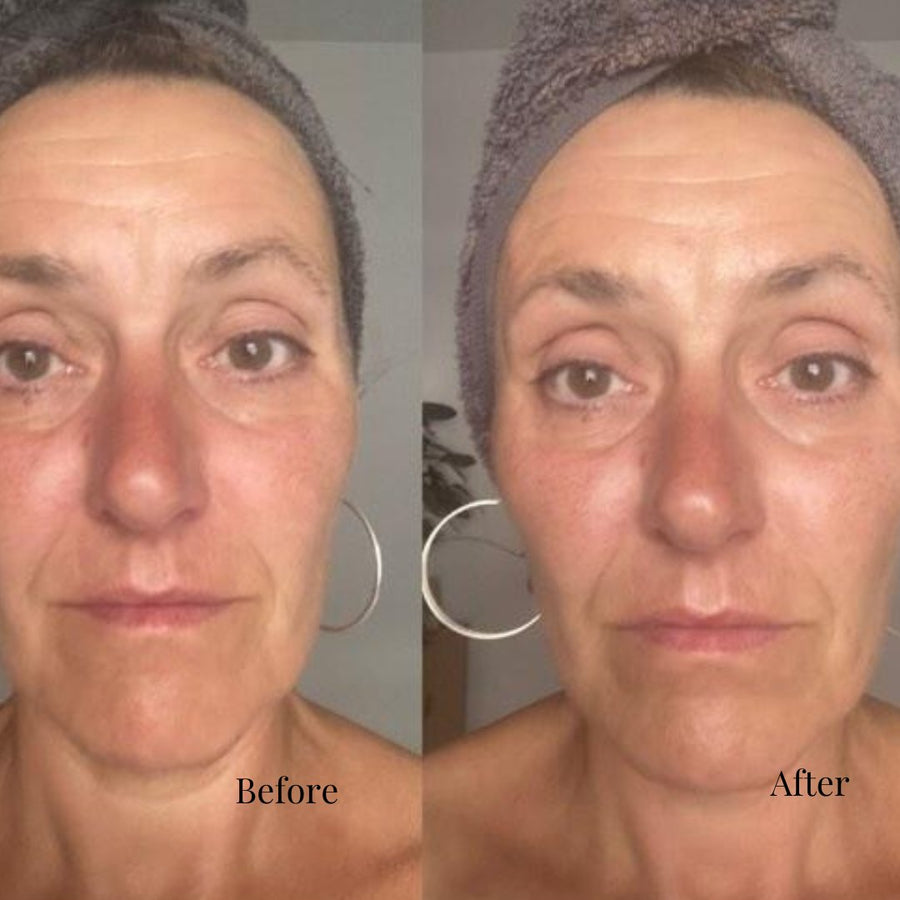 Skin Elixir Red Light Therapy Facial Radiance Wand - Skin Elixir UK