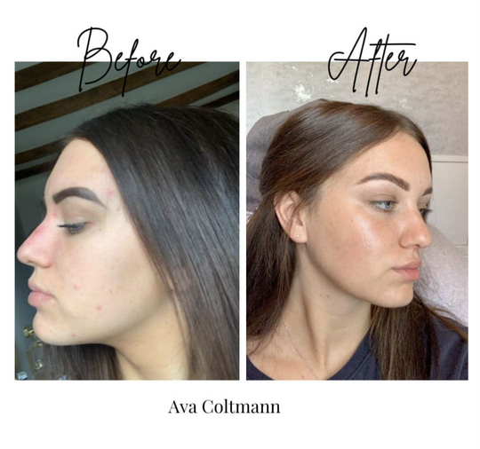 Why Natural Skincare is More Than a Trend: The science behind the glow