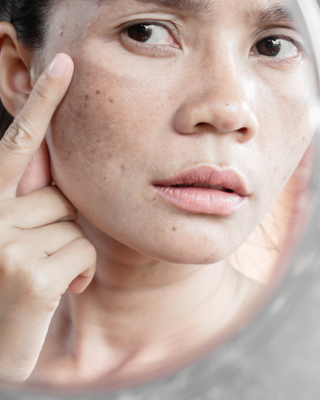 Menopause and Your Skin: What's Really Happening (And What Actually Helps)